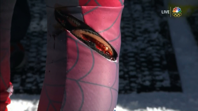 Illustration for article titled Bode Miller Wrecks At World Championships, Gets Disgusting Open Wound